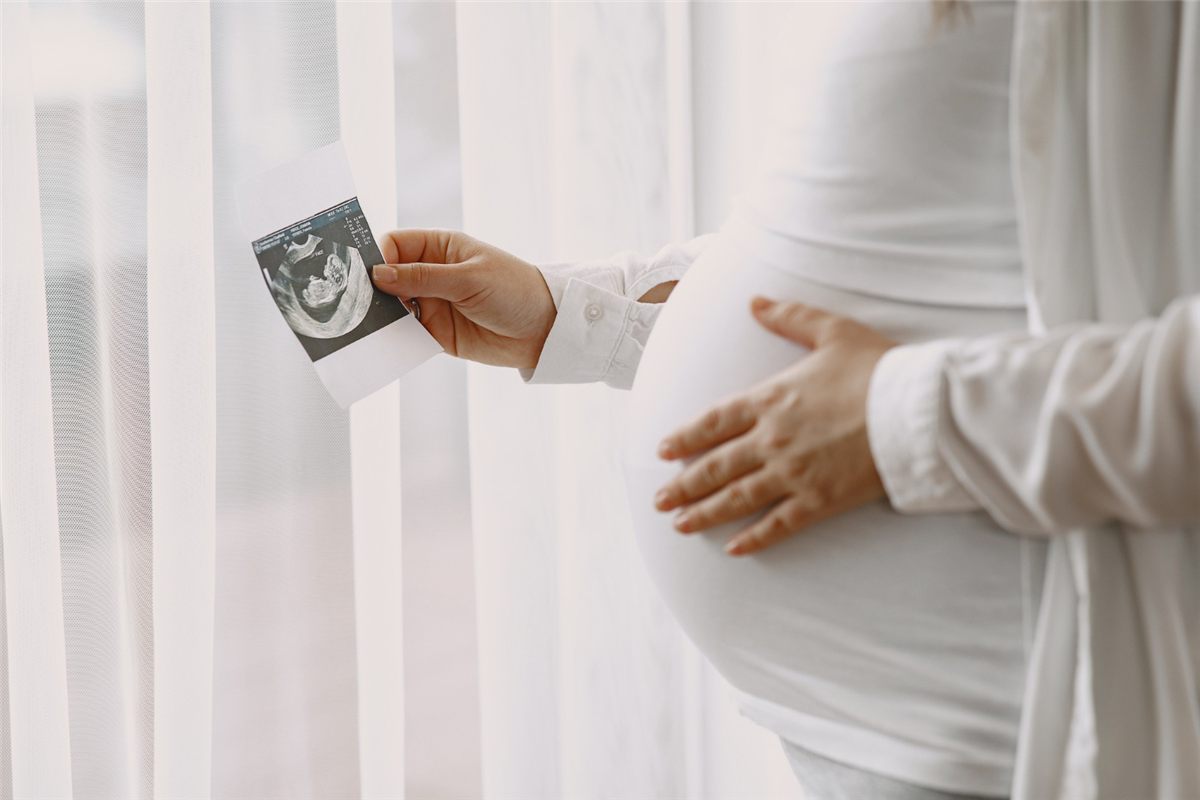 Gestante segurando a imagem de um ultrassom junto à barriga